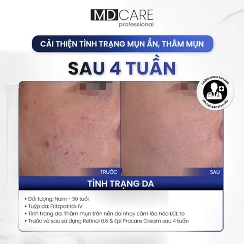 Kem Dưỡng Ẩm MD Care PRO-Retinol 0.6+Tặng sữa rửa mặt 30ml - Giảm Nếp Nhăn, Tăng Độ Đàn Hồi, Dưỡng Da Mịn Mượt, trẻ hóa Dành Cho Mọi Loại Da