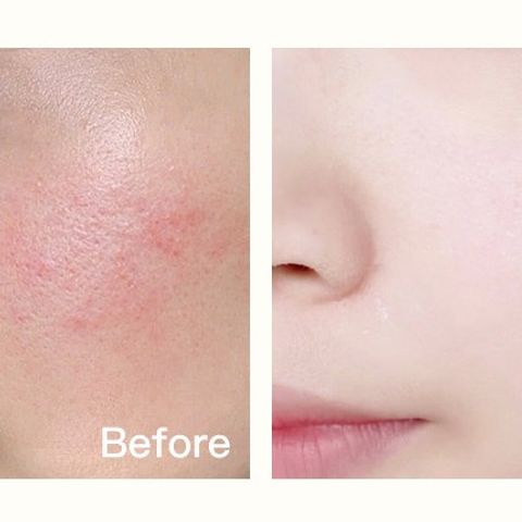 Máy Massage Nâng Cơ Mặt HIH - Thiết Bị Chăm Sóc Da Chất Lượng Cao Với Rung Điện Đẩy Tinh Chất Dưỡng Da Sáng Khỏe