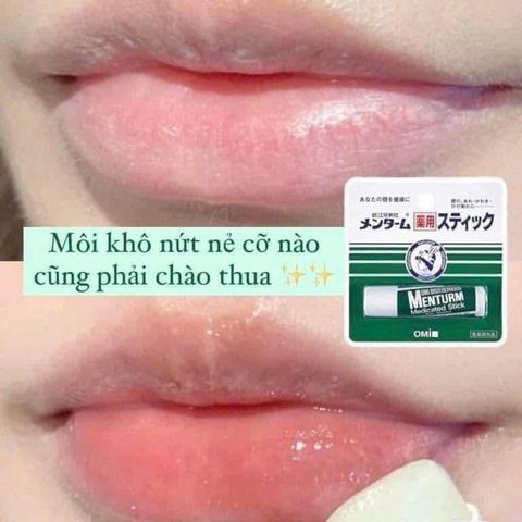 Son Dưỡng Môi Menturm Omi Medicated Stick XD - Cung Cấp Độ Ẩm Tối Đa, Chống Oxy Hóa, Dễ Dàng Mang Theo - Sản Phẩm Nhật Bản Chính Hãng