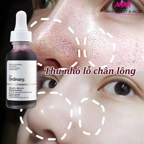 Tinh Chất Tẩy Da Chết Hóa Học The Ordinary AHA 30% + BHA 2% - Giải Pháp Lột Tẩy Da Tại Nhà, 30ml Chăm Sóc Da Mịn Màng, Nguyên Chất 100%