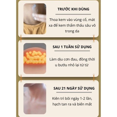 Kem Tan Hạch Bạch Huyết Nhật Bản - Giảm Bướu Cổ, Hỗ Trợ Teo Hạch, Cải Thiện Lưu Thông Mạch Máu, Sản Phẩm Chăm Sóc Sức Khỏe 30g