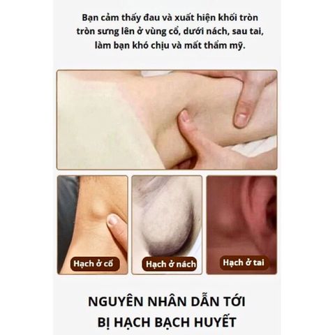 Kem Tan Hạch Bạch Huyết Nhật Bản - Giảm Bướu Cổ, Hỗ Trợ Teo Hạch, Cải Thiện Lưu Thông Mạch Máu, Sản Phẩm Chăm Sóc Sức Khỏe 30g