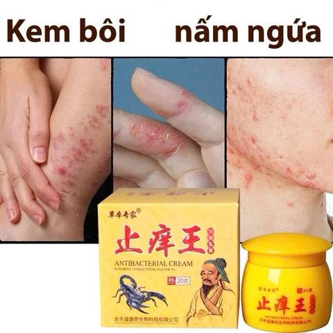 Kem Dưỡng Da Bọ Cạp Vàng Ông Già - Hỗ Trợ Giảm Ngứa, Làm Dịu Da Hắc Lào, Lang Ben, Tổ Đỉa và Vảy Nến, Chống Kích Ứng 20g