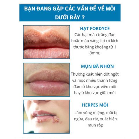 Kem Dưỡng Môi Hạt Fordyce SUMIFUN - Giải Pháp Chăm Sóc Môi Khô Nứt Nẻ, Làm Hồng Môi Tự Nhiên, Thẩm Thấu Nhanh