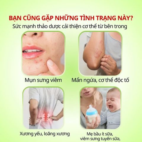 Trà Bồ Công Anh Phú Hưng AP - Hỗ Trợ Làm Đẹp Da, Chống Viêm, Thanh Nhiệt, Lợi Sữa, Thảo Dược Tự Nhiên Detox Cơ Thể