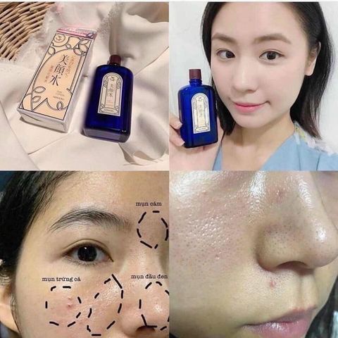 Nước Hoa Hồng Giảm Mụn Meishoku Bigansui Nhật Bản 90ml - Dưỡng Da Sáng Mịn, Ngăn Ngừa Mụn Từ Thiên Nhiên