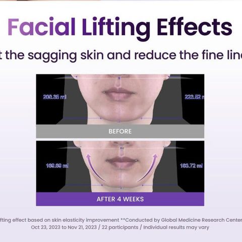 Set Kem Dưỡng Nâng Cơ Mặt BIOHEAL BOH Probioderm 3D Lifting Cream 50mL + Refill - Cấp Ẩm và Trẻ Hóa Da Từ Thiên Nhiên