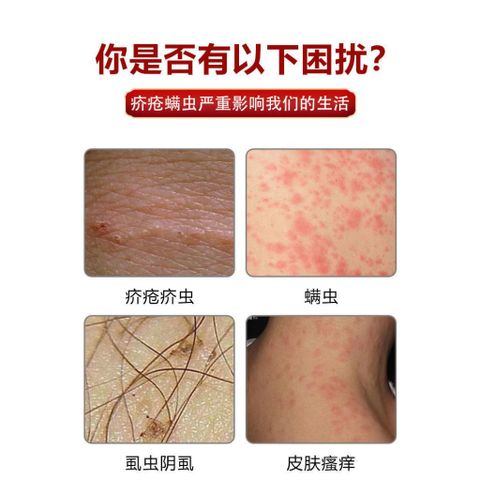 Kem Lưu Huỳnh Baiyangfu 10% & 20% – Giảm Ngứa, Chăm Sóc Da Ghẻ, Nấm Chuyên Biệt 50g, An Toàn Cho Da Nhạy Cảm