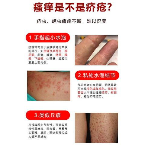 Kem Lưu Huỳnh Baiyangfu 10% & 20% – Giảm Ngứa, Chăm Sóc Da Ghẻ, Nấm Chuyên Biệt 50g, An Toàn Cho Da Nhạy Cảm