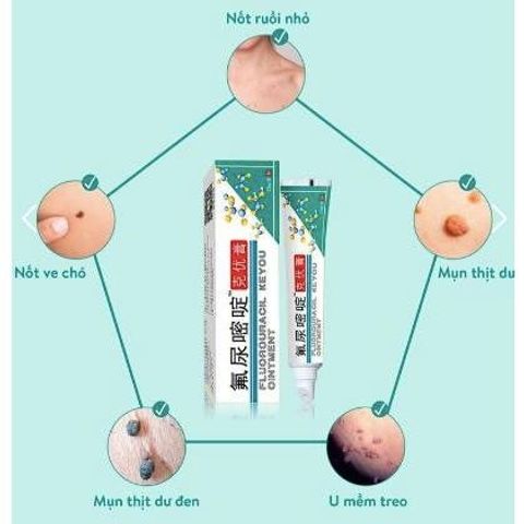 Kem Rụng Mụn Thịt Dư Keyou - Chăm Sóc Da, Cải Thiện Mụn Thịt và Nốt Ruồi - Sản Phẩm Đài Loan Tự Nhiên 20g