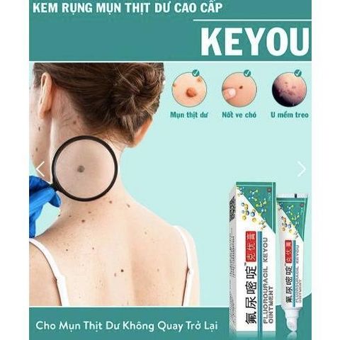 Kem Rụng Mụn Thịt Dư Keyou - Chăm Sóc Da, Cải Thiện Mụn Thịt và Nốt Ruồi - Sản Phẩm Đài Loan Tự Nhiên 20g