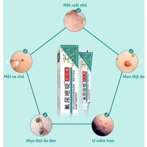 Kem Rụng Mụn Thịt Dư Keyou - Chăm Sóc Da, Cải Thiện Mụn Thịt và Nốt Ruồi - Sản Phẩm Đài Loan Tự Nhiên 20g