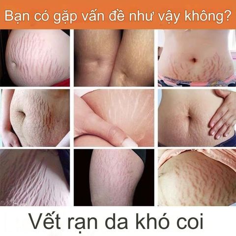 Kem Dưỡng Da 40g - Chống Rạn Da, Dưỡng Ẩm, Làm Sáng Da, Tăng Độ Săn Chắc - Sản Phẩm Chăm Sóc Da Tự Nhiên