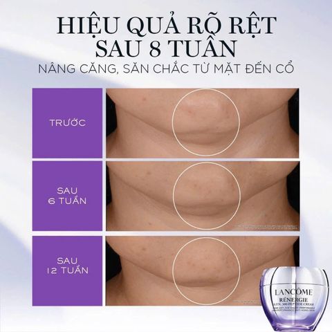 Kem Dưỡng Da Lancome Renergie H.P.N. 300-Peptide 15ml - Chống Nhăn, Săn Chắc, Cấp Ẩm, Dưỡng Da Sáng Khỏe