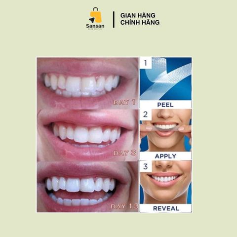 Set Dán Trắng Răng Crest 3D Whitestrips - 20 Miếng Chuyên Sâu + 10 Miếng Duy Trì, Hiệu Quả Tại Nhà, An Toàn Cho Men Răng