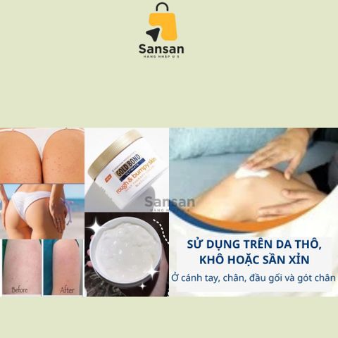 Kem Dưỡng Da Toàn Thân GOLD BOND Ultimate - Giảm Khô Sần, Cấp Ẩm Mịn Màng, 226g