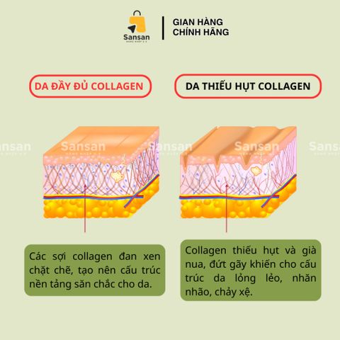 Viên Uống Collagen Youtheory Mỹ 390 Viên - Hỗ Trợ Làm Đẹp Da, Giảm Lão Hóa, Tái Tạo Độ Đàn Hồi - Collagen Loại 1, 2 & 3