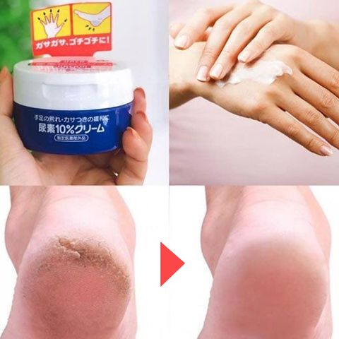 Kem chăm sóc nứt nẻ da chân tay Shiseido Urea Nhật Bản 100g