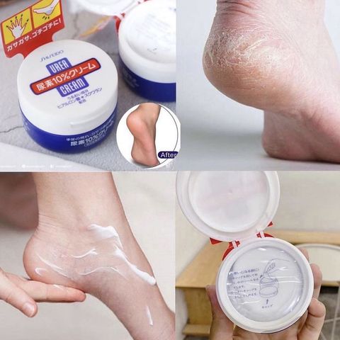 Kem chăm sóc nứt nẻ da chân tay Shiseido Urea Nhật Bản 100g