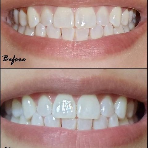 Kem Đánh Răng Nuskin AP24 Whitening Fluoride - Sạch Mảng Bám, Hơi Thở Thơm Mát, Hàng Nhập Khẩu Mỹ, 110g