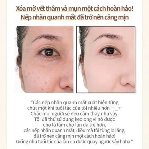[HỎA TỐC]Serum keo ong Propolis 1000 Wellderma Hàn Quốc, dưỡng ẩm trắng da