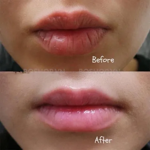Son dưỡng môi carmex SPF15 siêu cấp ẩm làm mềm môi