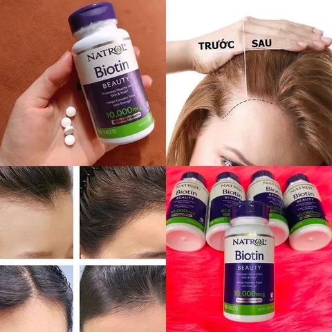 Viên Uống Mọc Tóc, Ngăn Rụng Tóc Natrol Biotin 10.000mcg của Mỹ