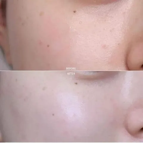 [Bill Mỹ] Kem dưỡng da hoa cúc Kiehl's Calendula Serum Infused Water Cream 100ml