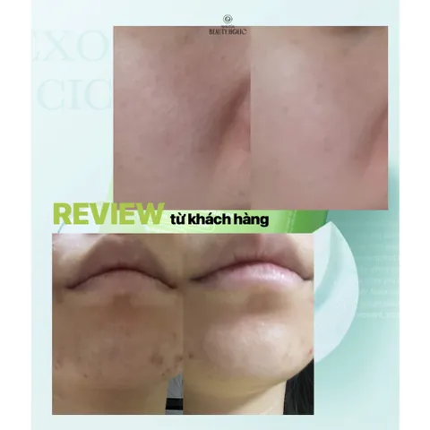 Bộ Line Dưỡng Medicube Exosome Cica – Làm Dịu, Giảm Mụn, Phục Hồi Da Nhạy Cảm, Dưỡng Ẩm, Căng Mịn