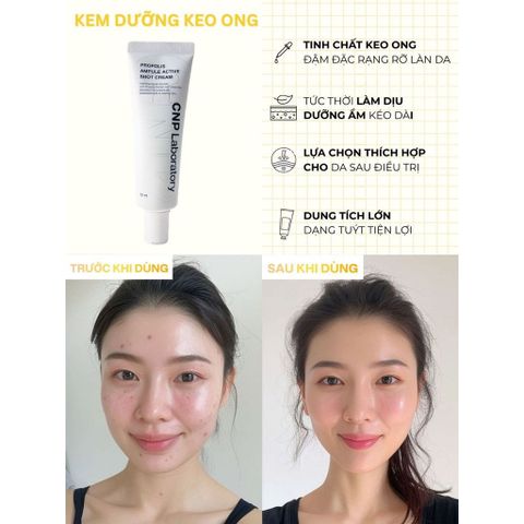 Kem Dưỡng Ẩm CNP Propolis 75ml - Khôi Phục Da, Làm Dịu, Dưỡng Ẩm Chuyên Sâu cho Da Nhạy Cảm và Thường