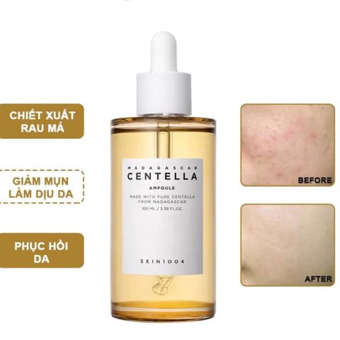 Tinh Chất Serum Rau Má Skin1004 Madagascar Centella 100ml - Giải Quyết Mụn và Da Nhạy Cảm, Làm Dịu và Phục Hồi Da Tổn Thương