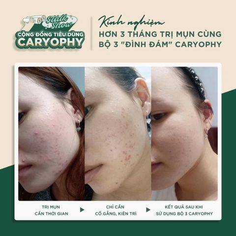 Tinh Chất Serum Caryophy Portulaca 30ml - Giảm Mụn, Làm Dịu Da, Cải Thiện Thâm Sẹo, Phù Hợp Mọi Loại Da