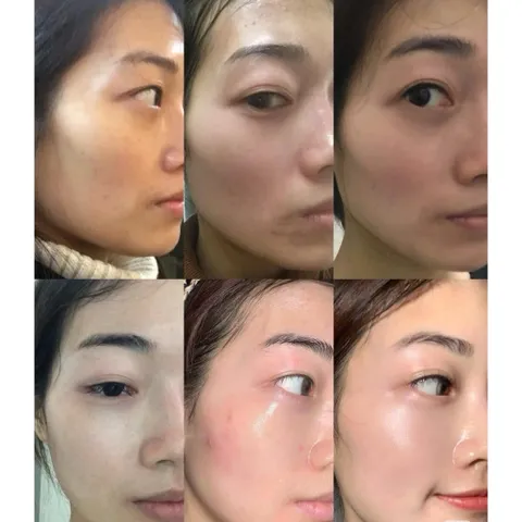 Tinh Chất Murad Retinol Youth Renewal Serum 30ml – Tái Tạo Da, Chống Oxy Hóa, Giảm Nếp Nhăn