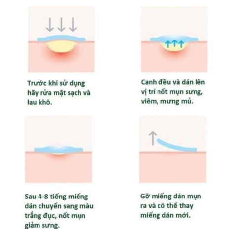 Miếng Dán Mụn Cosrx Acne Pimple Master Patch / Clear Fit Master Patch 387782