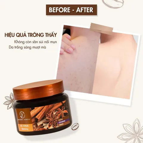 Tẩy Da Chết Cơ Thể Body Quế Hồi Coffee 380g – Làm Mịn Da, Giảm Viêm Lỗ Chân Lông, Dưỡng Da Săn Chắc