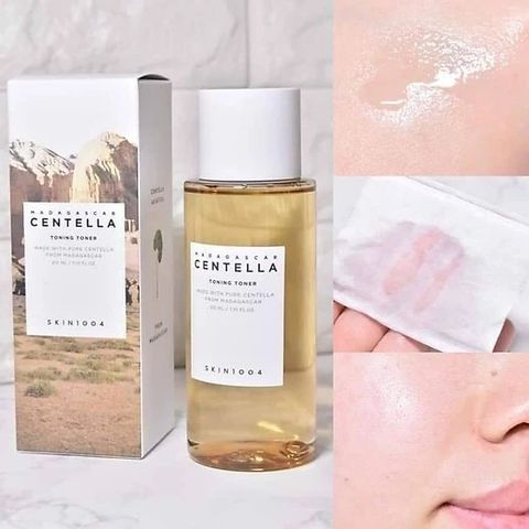 Toner Rau Má SKIN1004 Madagascar Centella 210ml - Làm Dịu & Phục Hồi Da Nhạy Cảm, Da Mụn, Cấp Ẩm, Se Khít Lỗ Chân Lông