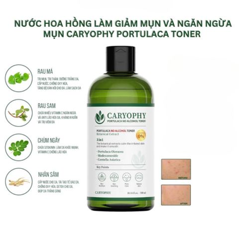 Nước Hoa Hồng Caryophy Portulaca Toner 300ml - Giảm Mụn, Làm Dịu Da, Cân Bằng pH, Chăm Sóc Da Dầu, Thương Hiệu Hàn Quốc