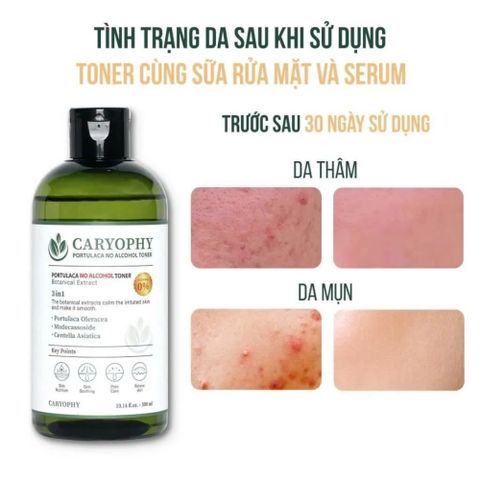 Nước Hoa Hồng Caryophy Portulaca Toner 300ml - Giảm Mụn, Làm Dịu Da, Cân Bằng pH, Chăm Sóc Da Dầu, Thương Hiệu Hàn Quốc