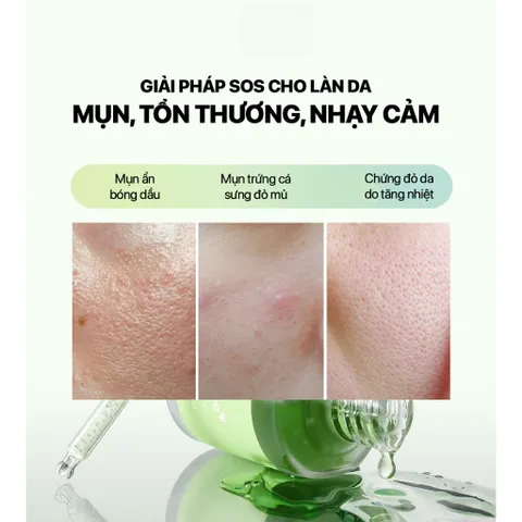 Bộ Line Dưỡng Medicube Exosome Cica – Làm Dịu, Giảm Mụn, Phục Hồi Da Nhạy Cảm, Dưỡng Ẩm, Căng Mịn 388352