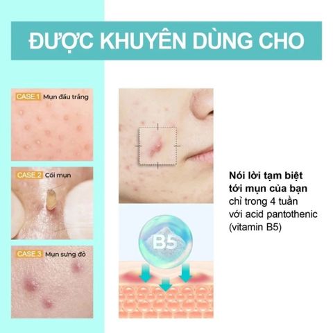 Kem Dưỡng Ẩm Numbuzin No.1 Pantothenic B5 80ml - Làm Dịu Da, Giảm Dầu Mụn, Phục Hồi, Dưỡng Ẩm Sâu Cho Da Nhạy Cảm Hàn Quốc