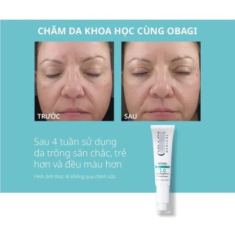 Kem Tái Tạo Da Obagi Retinol 1.0 & 360 Retinol 0.5 28g - Dưỡng Da Sáng Mịn, Giảm Nếp Nhăn, Ngăn Lão Hóa