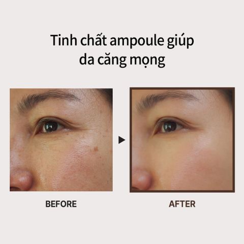 Bộ Đôi Serum Và Kem Dưỡng Chống Lão Hóa Medi-Peel Bor-Tox 30ml & 50ml – Làm Căng Bóng, Trẻ Hóa Da Chuyên Sâu