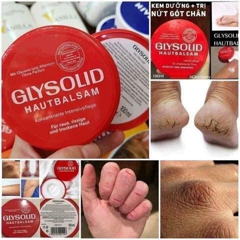 Kem Dưỡng Nứt Nẻ Tay Chân Glysolid 100ml - Làm Mềm Da, Giảm Khô Ráp, Dưỡng Ẩm Sâu Cho Da Nhạy Cảm