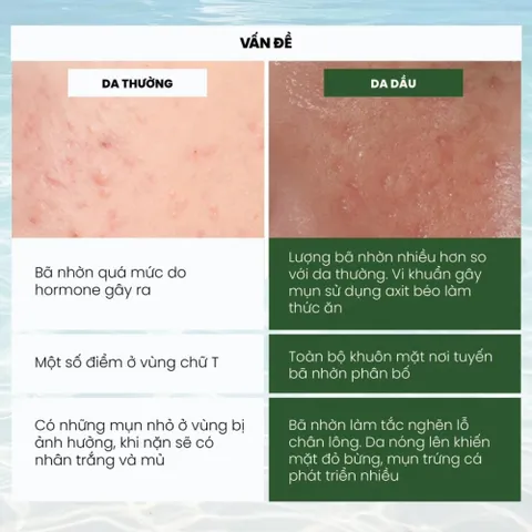 Bộ Đôi Kem Dưỡng Và Serum Dr. Melaxin Lipino Ngừa Mụn – Kem 50g & Serum 30ml 388513