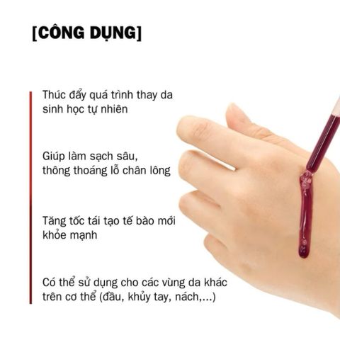 Tinh Chất Serum Red Peel Tingle So Natural 35ml - Tẩy Tế Bào Chết Hóa Học, Làm Sáng & Mịn Da, Giúp Thu Nhỏ Lỗ Chân Lông