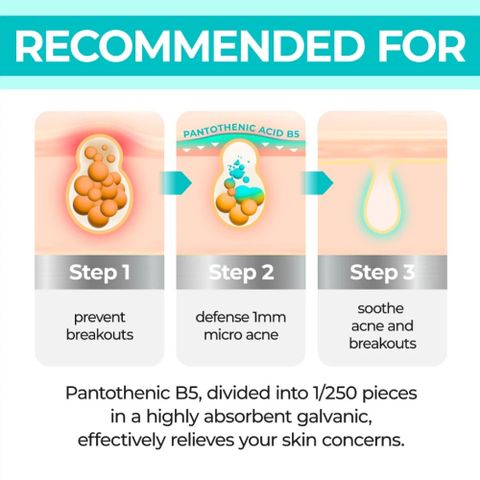 Serum Numbuzin No.1 Pantothenic B5 50ml – Làm Dịu, Phục Hồi Da, Kiểm Soát Dầu, Cấp Ẩm Nhanh, Giảm Thâm Mụn Hàn Quốc