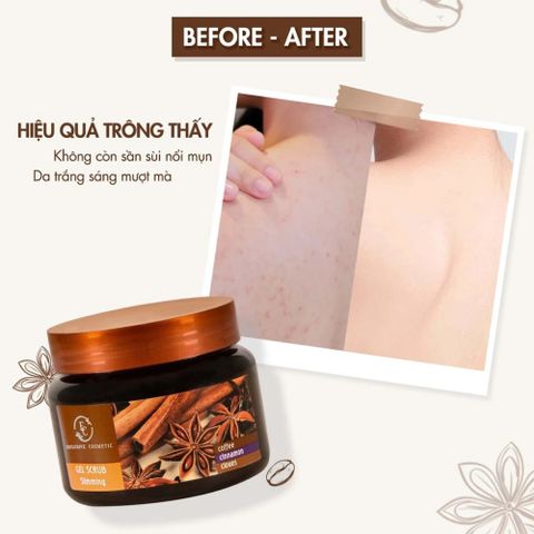 Tẩy Da Chết Cơ Thể Body Quế Hồi Coffee 380g – Làm Mịn Da, Giảm Viêm Lỗ Chân Lông, Dưỡng Da Săn Chắc 388625