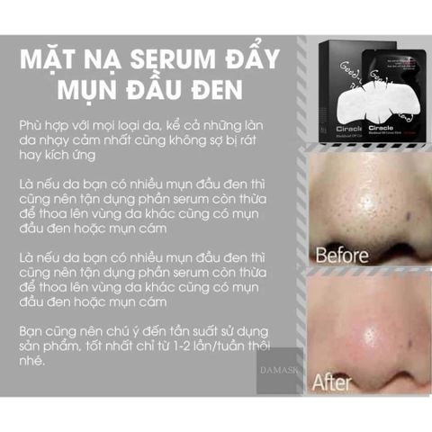 Mặt Nạ Đẩy Mụn Mũi Ciracle Good Bye Blackhead Cotton Mask - Hộp 20 Miếng Cho Da Dầu, Giảm Mụn Đầu Đen Hiệu Quả