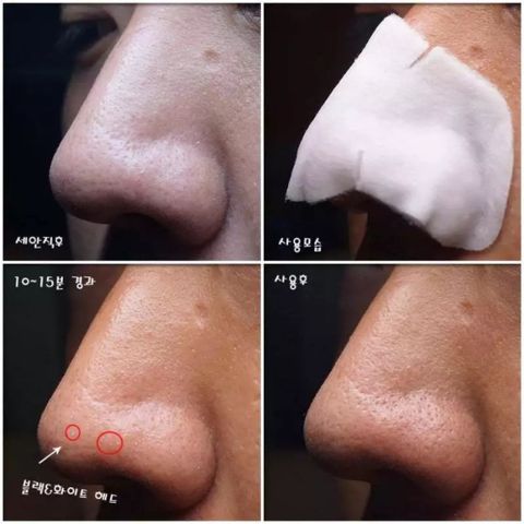 Mặt Nạ Đẩy Mụn Mũi Ciracle Good Bye Blackhead Cotton Mask - Hộp 20 Miếng Cho Da Dầu, Giảm Mụn Đầu Đen Hiệu Quả