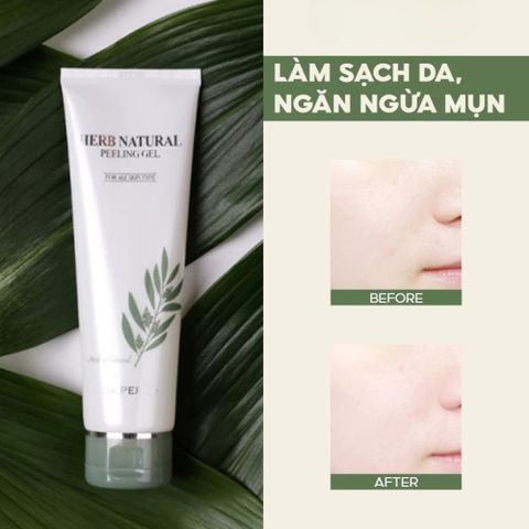 Gel Tẩy Tế Bào Chết Dr.Pepti Herb Natural 130ml - Tẩy Tế Bào Chết Dịu Nhẹ, Làm Sạch Sâu, Tái Tạo Da Mịn Màng, Hàn Quốc